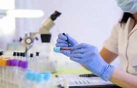 blood sample
